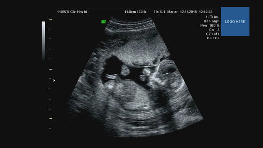 Fight for Life | Video